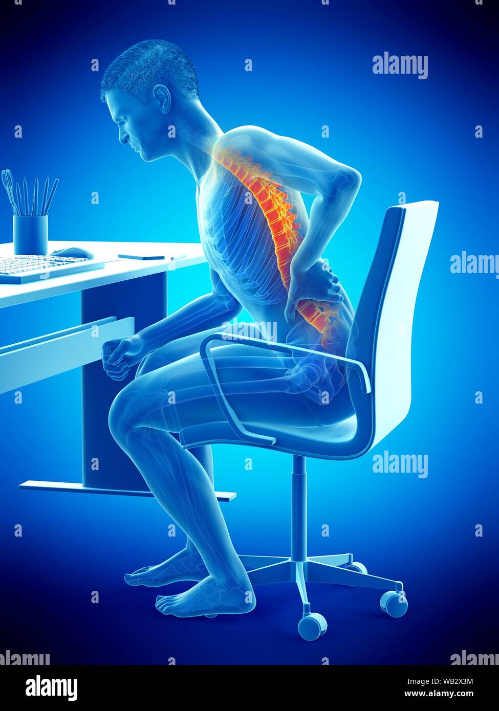 Dolore alla schiena a causa di seduta, illustrazione concettuale. Foto Stock