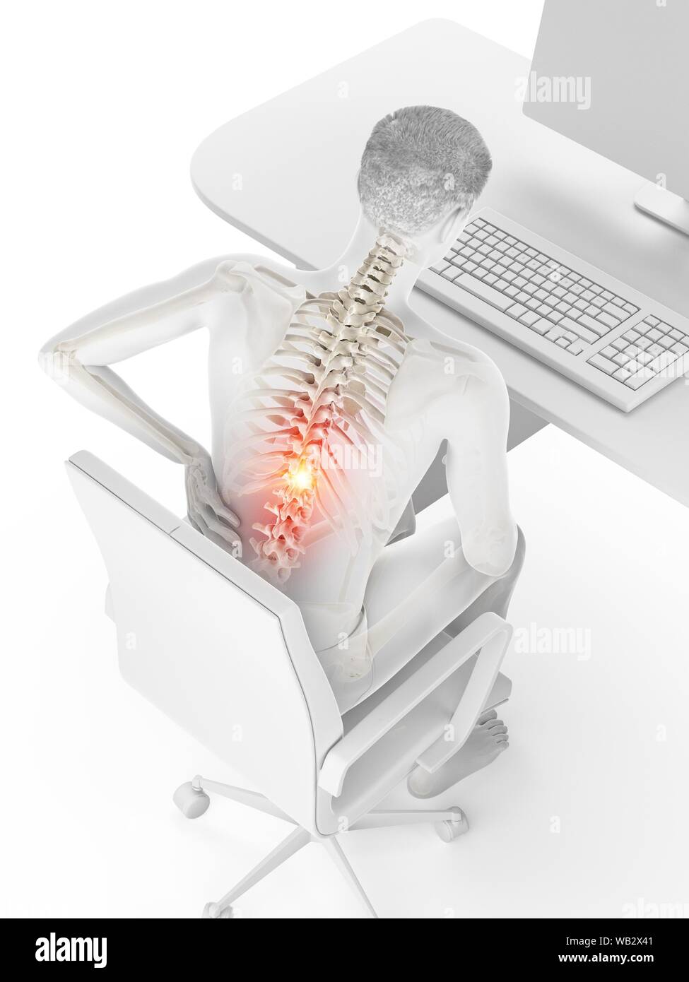 Dolore alla schiena a causa di seduta, illustrazione concettuale. Foto Stock