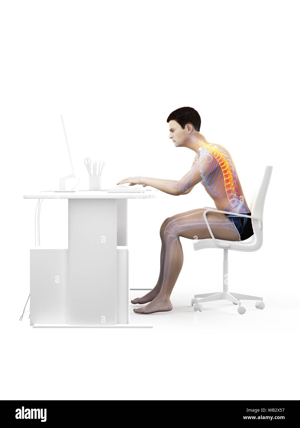 Dolore alla schiena a causa di seduta, illustrazione concettuale. Foto Stock