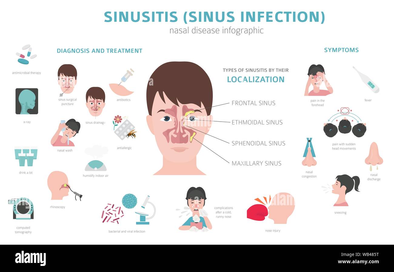 Malattie nasali. La sinusite, infezione sinusale la diagnosi e il trattamento medico design infografico. Illustrazione Vettoriale Illustrazione Vettoriale