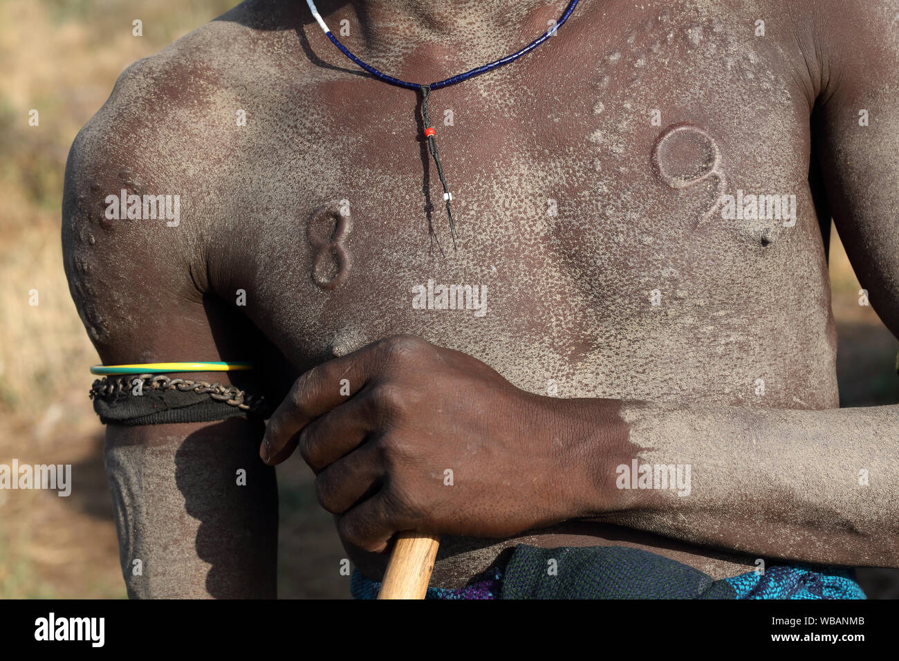 Scarificazione sulla parte superiore del corpo, tribù Mursi, bassa valle dell'Omo, Etiopia Foto Stock