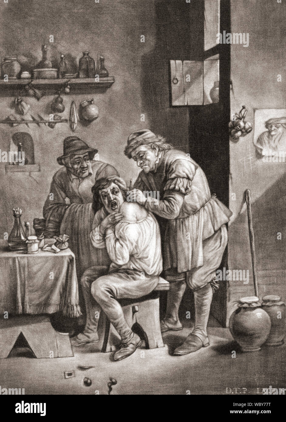 Un chirurgo esegue chirurgia su un uomo della spalla nel XVIII secolo. Dopo un edificio del XVIII secolo di lavoro. Foto Stock