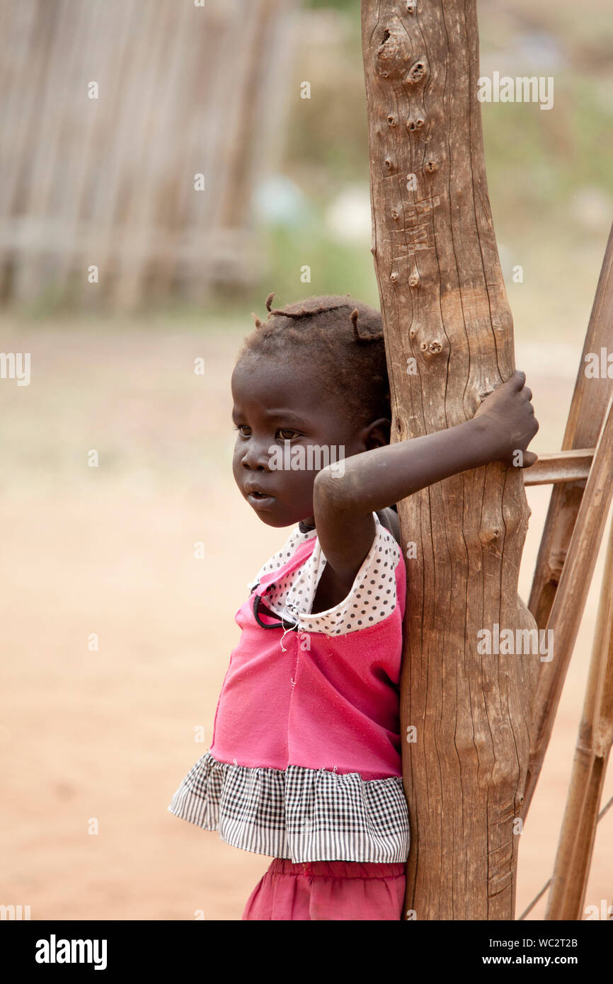 TORIT, SUD SUDAN-febbraio 21, 2013: bambino non identificato con i segni di malnutrizione nella città di Torit, sud Sudan Foto Stock