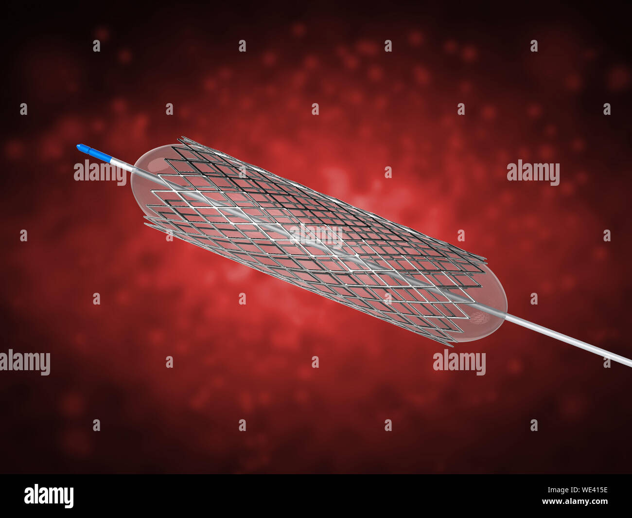 3D rendering stent o catetere per angioplastica a palloncino Foto Stock