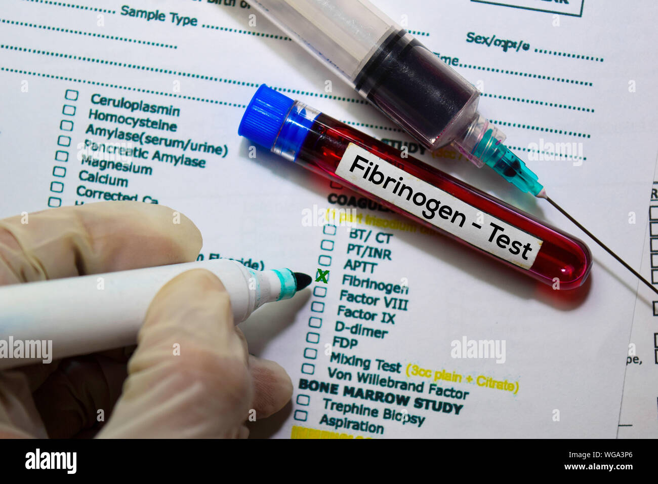 Fibrinogeno - Test con il campione di sangue. Vista superiore isolata sulla scrivania in ufficio. Assistenza sanitaria/concetto medico Foto Stock