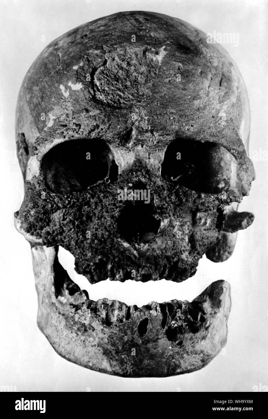 Cranio di vecchio uomo di Cromagnon. Vecchia età della pietra sapiens tipo. Foto Stock