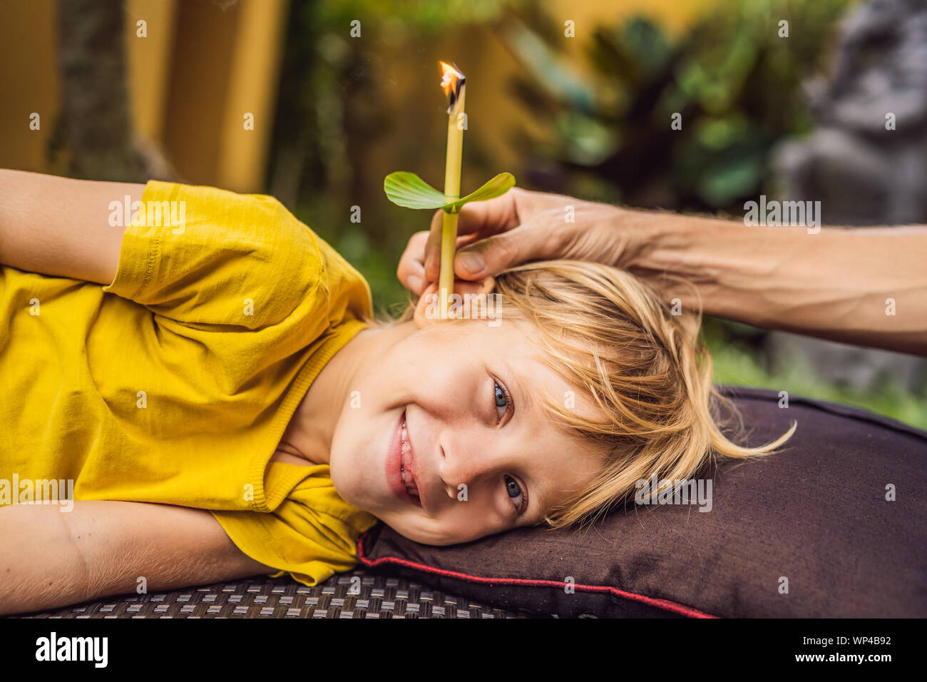 Il ragazzo riceve una procedura con un orecchio candela, bambini le orecchie salute, buona audizione, cerume Foto Stock