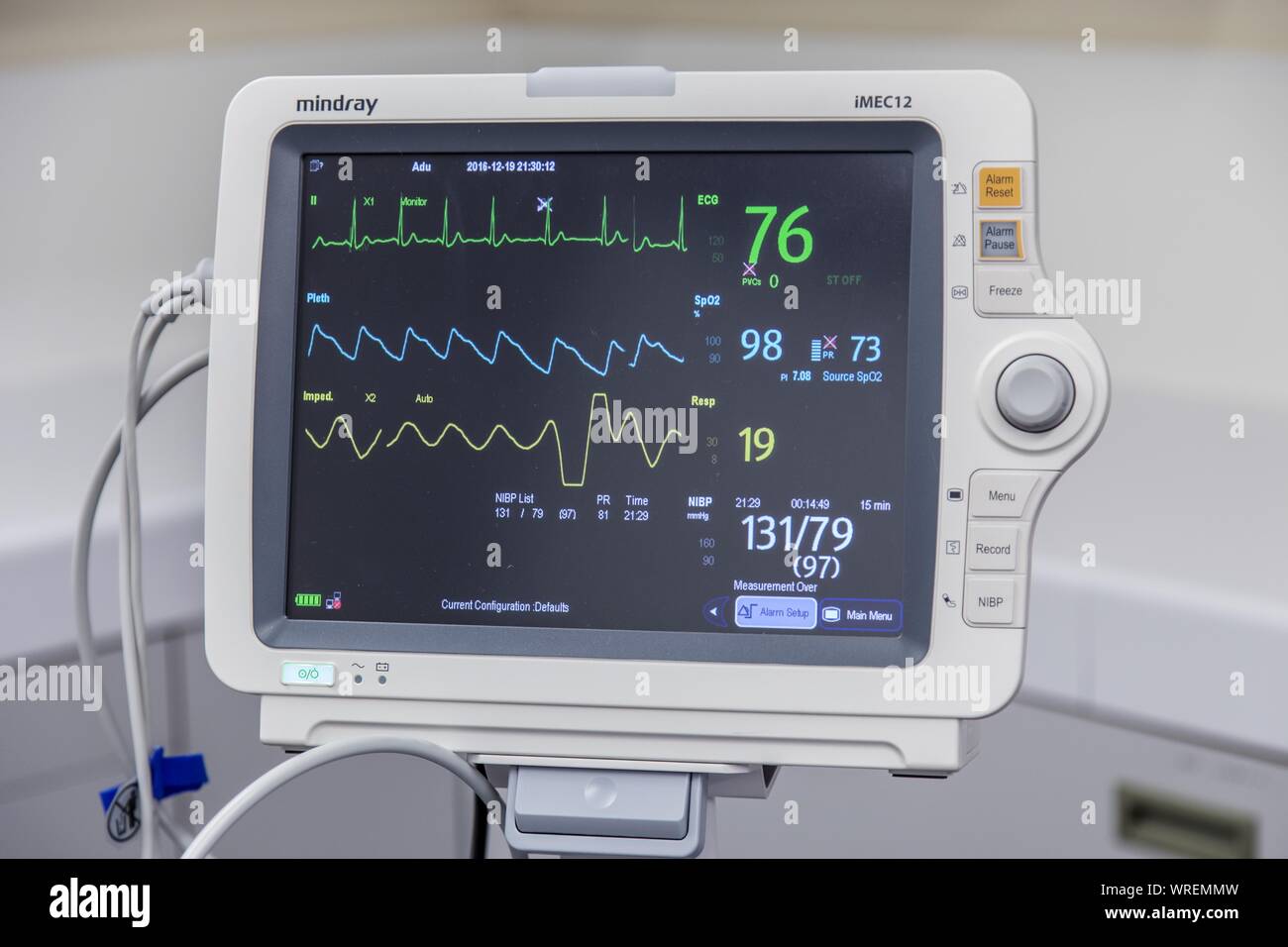 Mindray Imec 12 sub acuta di cura medica di dispositivo di monitoraggio paziente mostra pressione sanguigna e frequenza cardiaca. Foto Stock