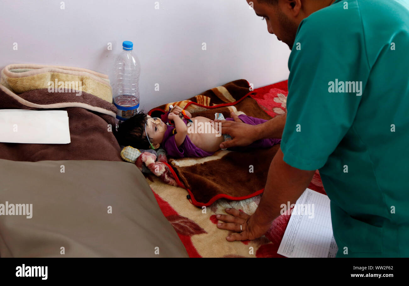 (190912) -- SANAA, Sett. 12, 2019 (Xinhua) -- Un medico controlla un bambini malnutriti in corrispondenza di un anti-malnutrizione centro di trattamento in ospedale Sabeen in Sanaa, Yemen, sul Sett. 12, 2019. Secondo una relazione pubblicata dall'UNICEF sulla luglio 31, circa 357 migliaia di bambini al di sotto dei 5 anni soffrono di malnutrizione severa acuta (SAM) in Yemen. (Foto di Mohammed Mohammed/Xinhua) Foto Stock