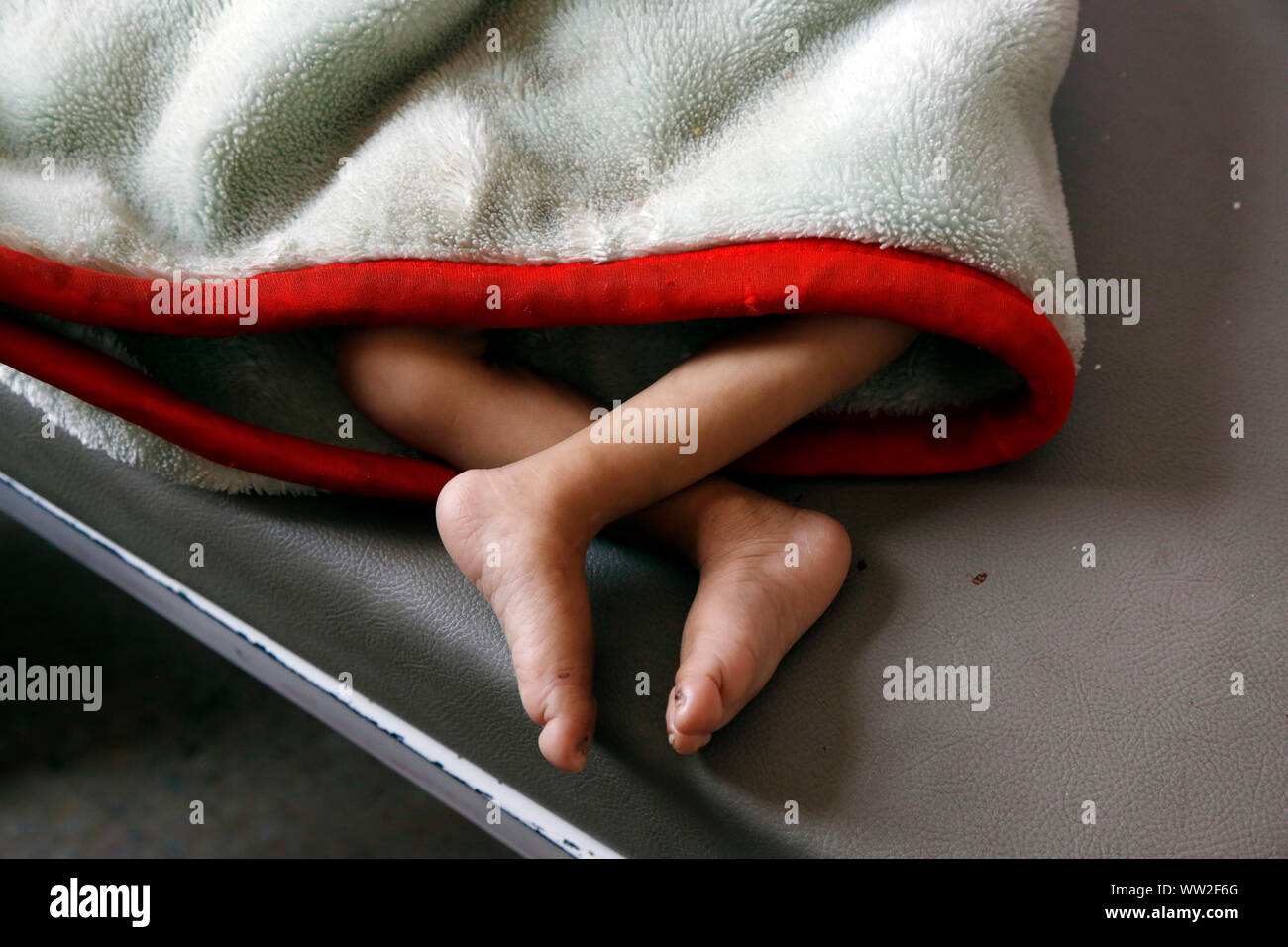(190912) -- SANAA, Sett. 12, 2019 (Xinhua) -- Un bambini malnutriti giace su un letto di un anti-malnutrizione centro di trattamento in ospedale Sabeen in Sanaa, Yemen, sul Sett. 12, 2019. Secondo una relazione pubblicata dall'UNICEF sulla luglio 31, circa 357 migliaia di bambini al di sotto dei 5 anni soffrono di malnutrizione severa acuta (SAM) in Yemen. (Foto di Mohammed Mohammed/Xinhua) Foto Stock