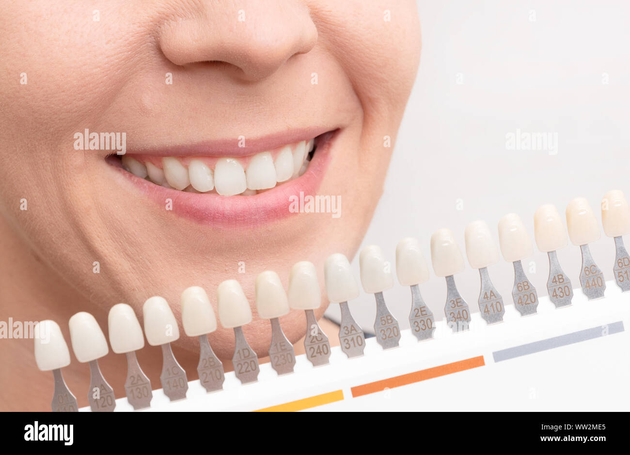 Donna sorridente con sani sbiancamento dei denti. Per le cure dentarie concetto. Foto Stock