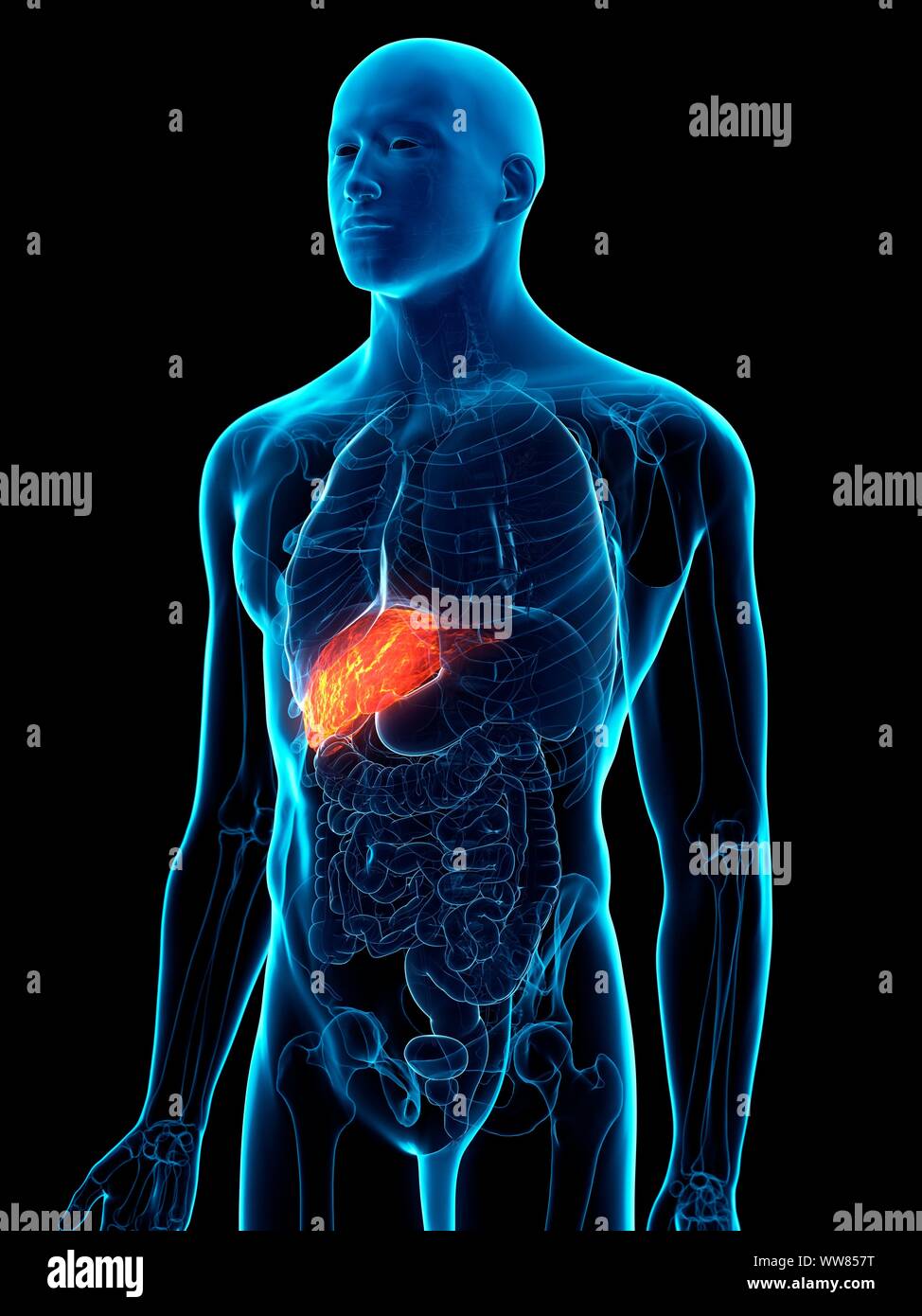 Fegato malato, illustrazione concettuale Foto Stock