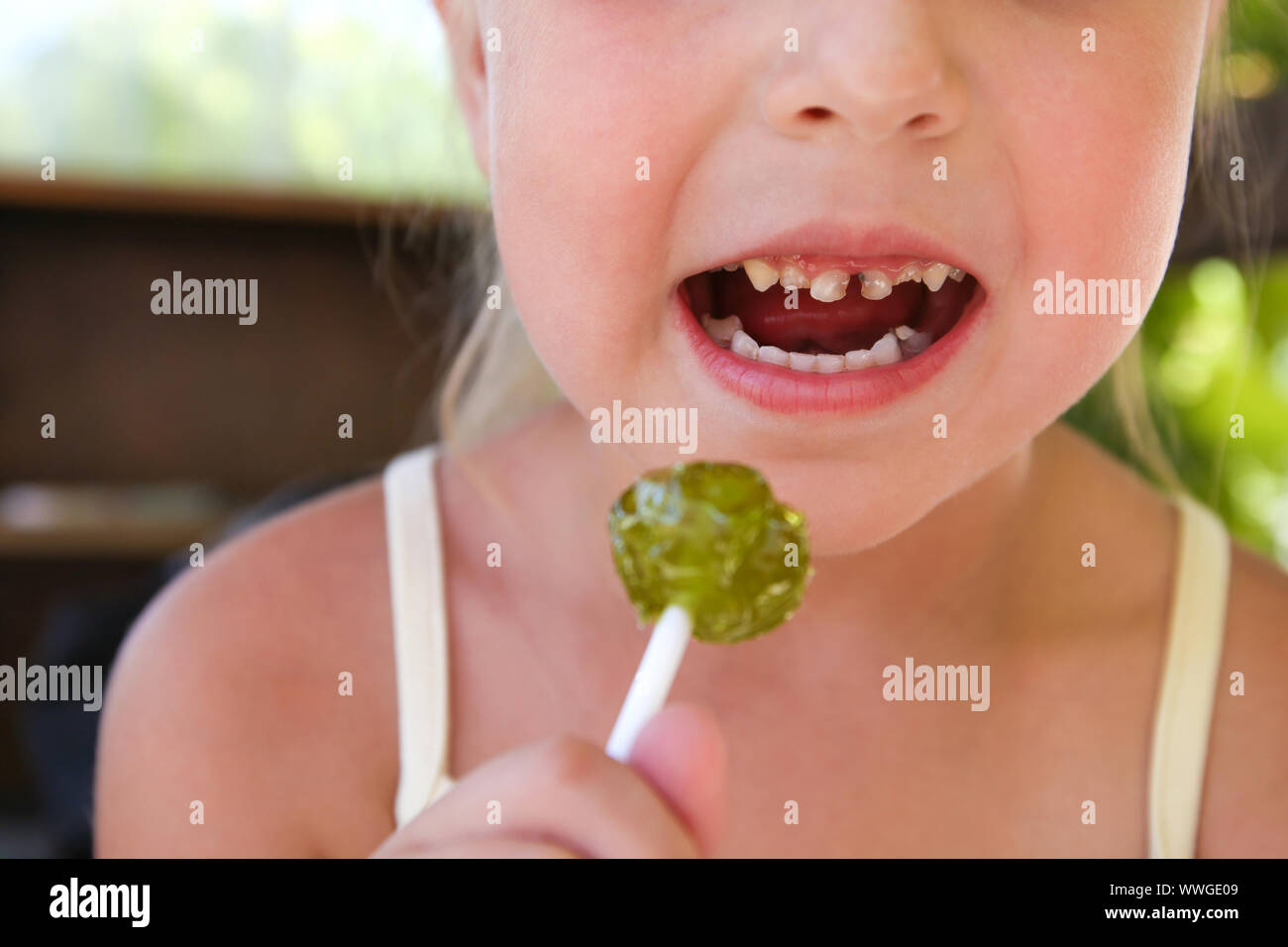 Bambino mangia caramelle. Ragazza ha la carie dei denti. Foto Stock