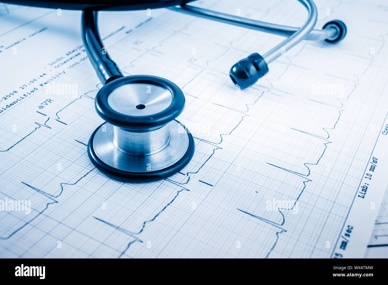 Uno stetoscopio sul concetto cardiogram per la cura del cuore Foto Stock