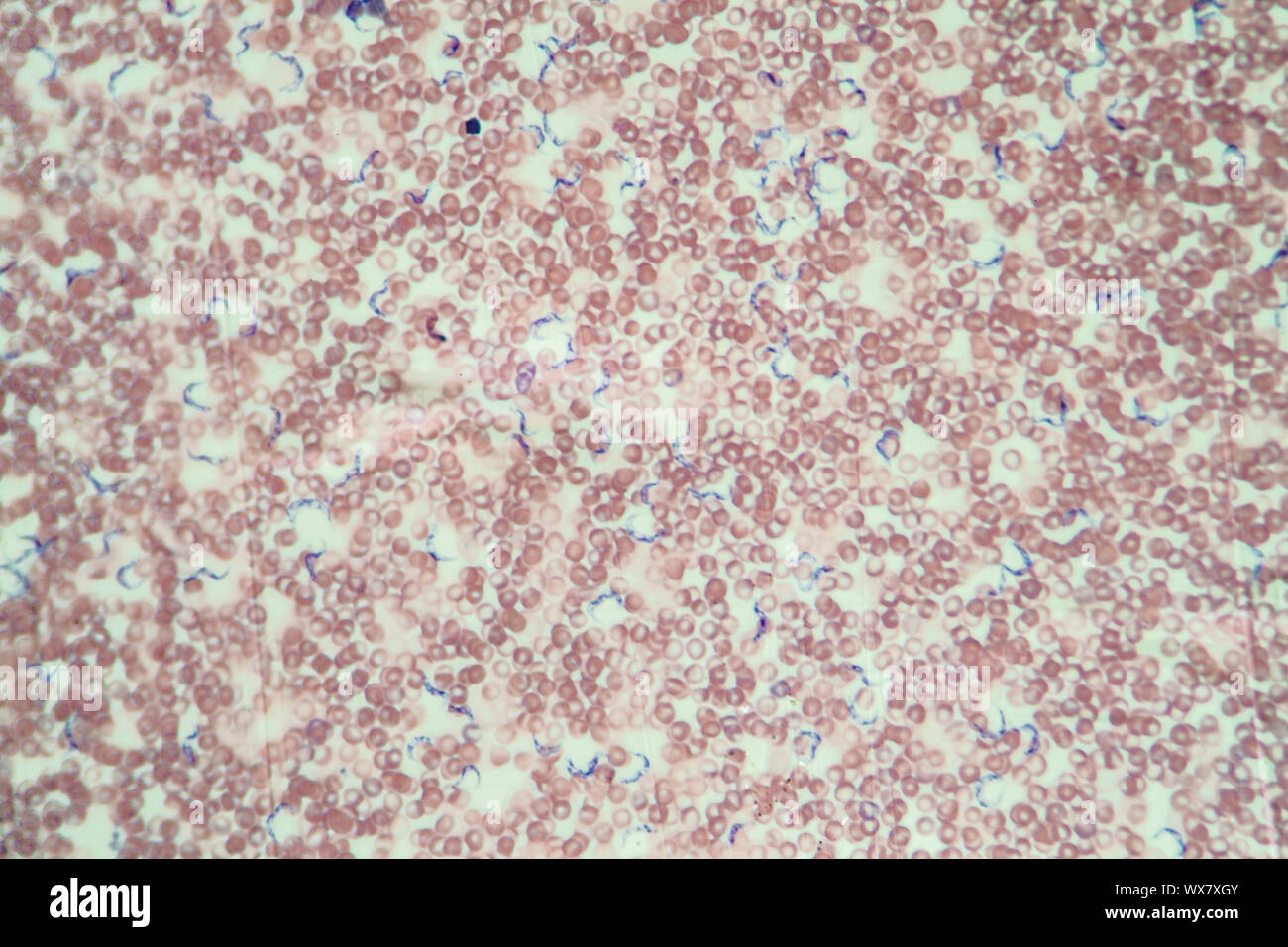 La malattia del sonno Trypanosomes 400x Foto Stock