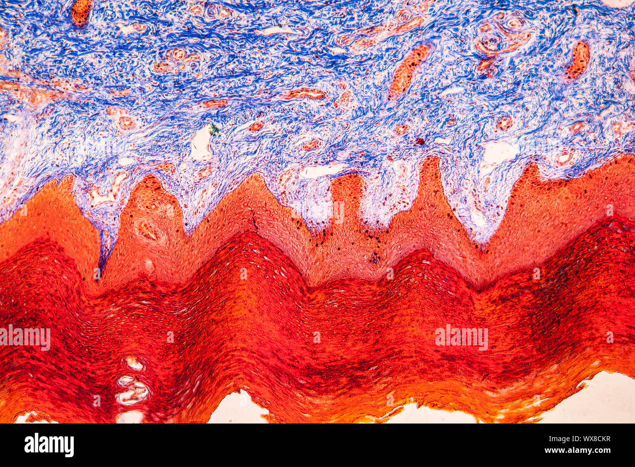 Il tessuto cicatriziale tessuti sotto il microscopio 100x Foto stock - Alamy