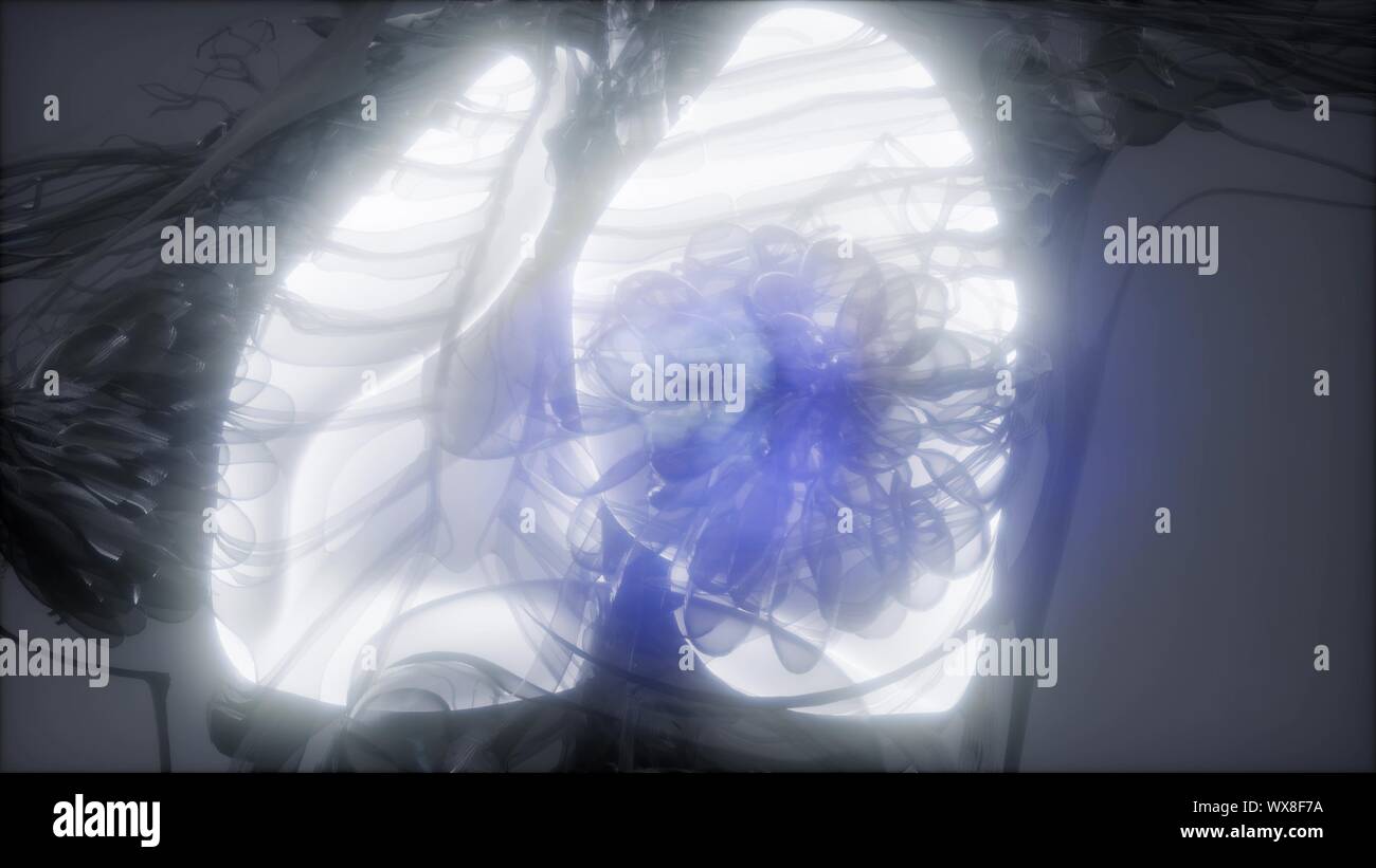 Polmoni umani esame radiologico Foto Stock