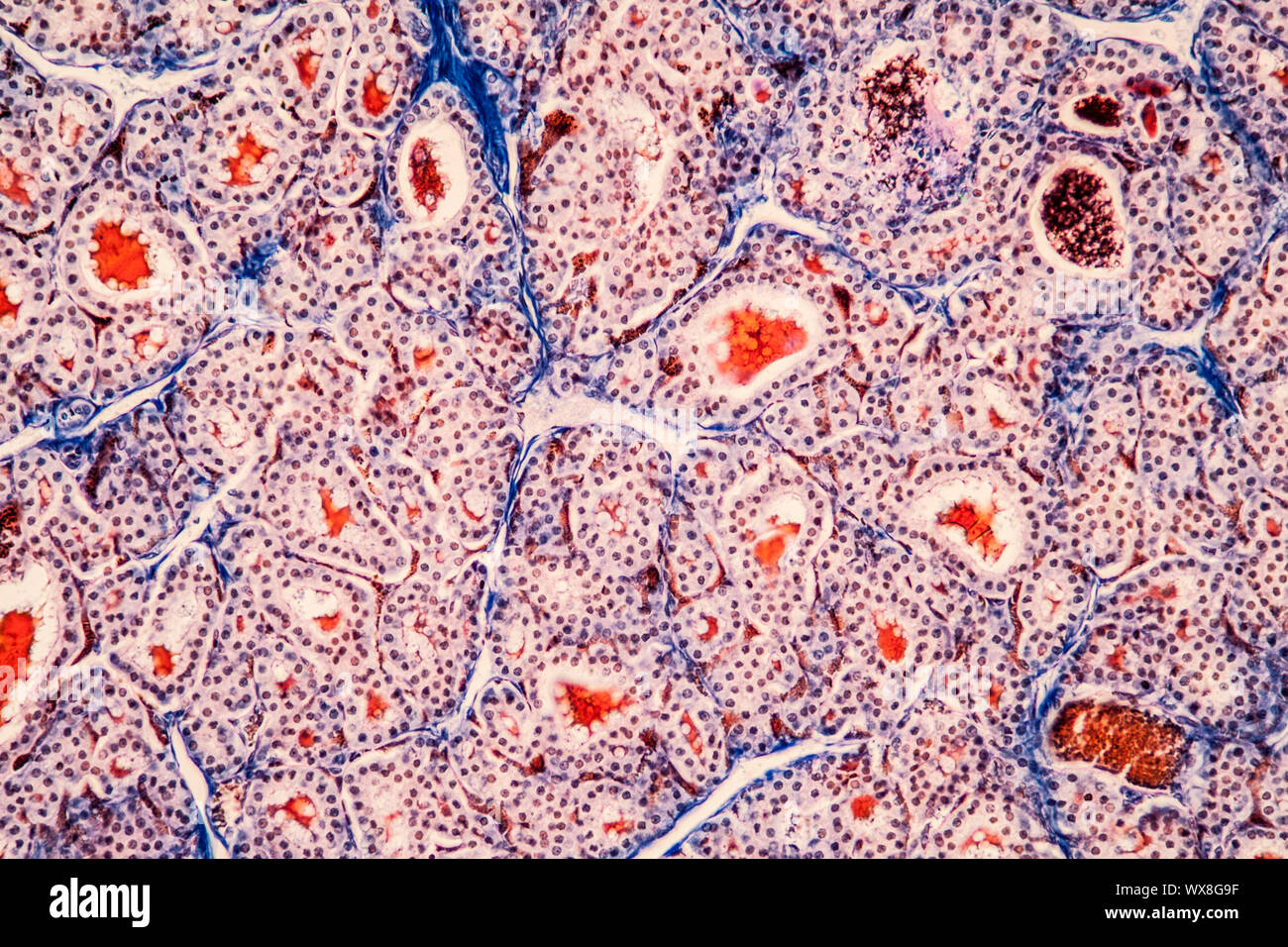 Il tessuto tiroide sotto il microscopio 200x Foto stock - Alamy