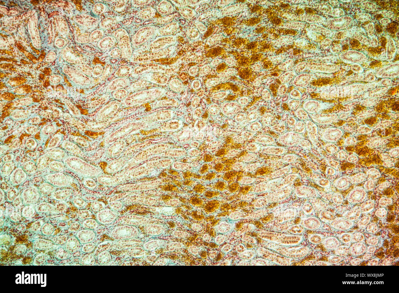 Ittero Rene il tessuto malato 100x Foto Stock