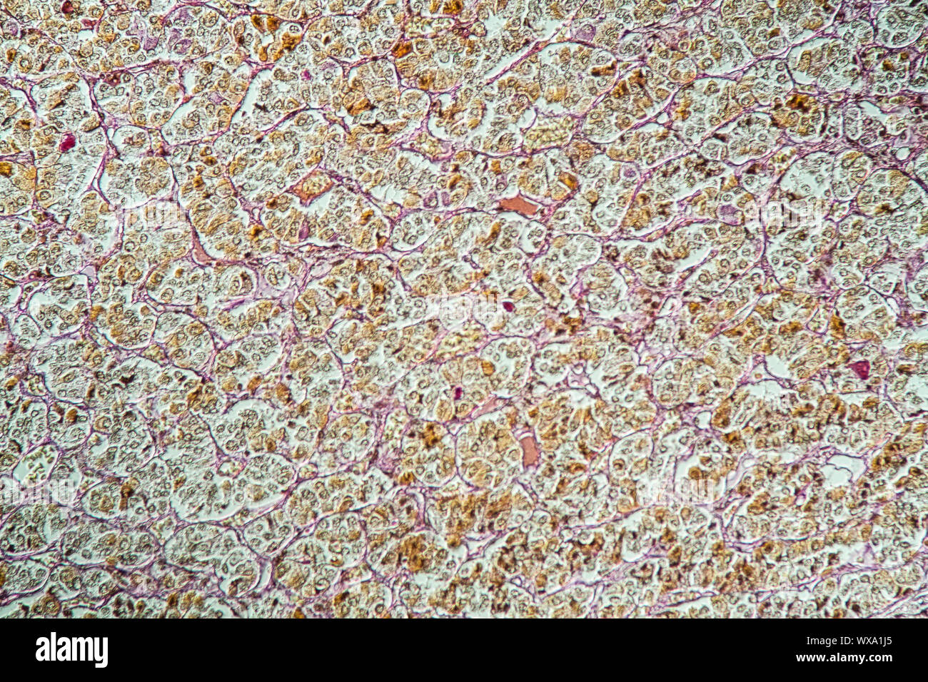 La ghiandola pituitaria ghiandola pituitaria sotto il microscopio 200x Foto Stock