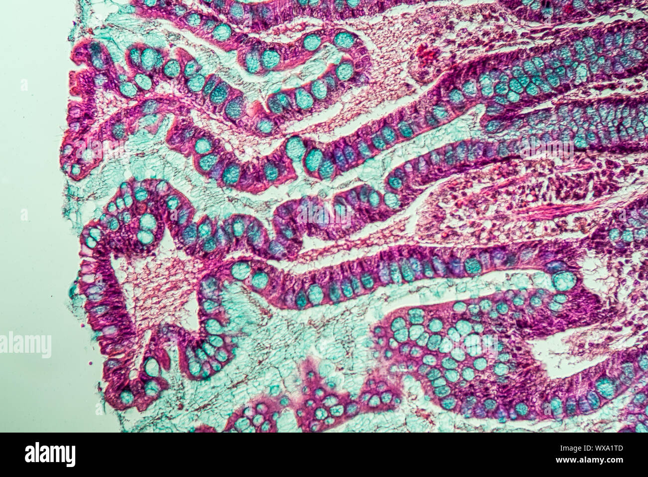 Il piccolo intestino con villi intestinali sotto il microscopio 200x Foto Stock Il piccolo intestino con villi intestinali sotto il microscopio 200x Foto Stock