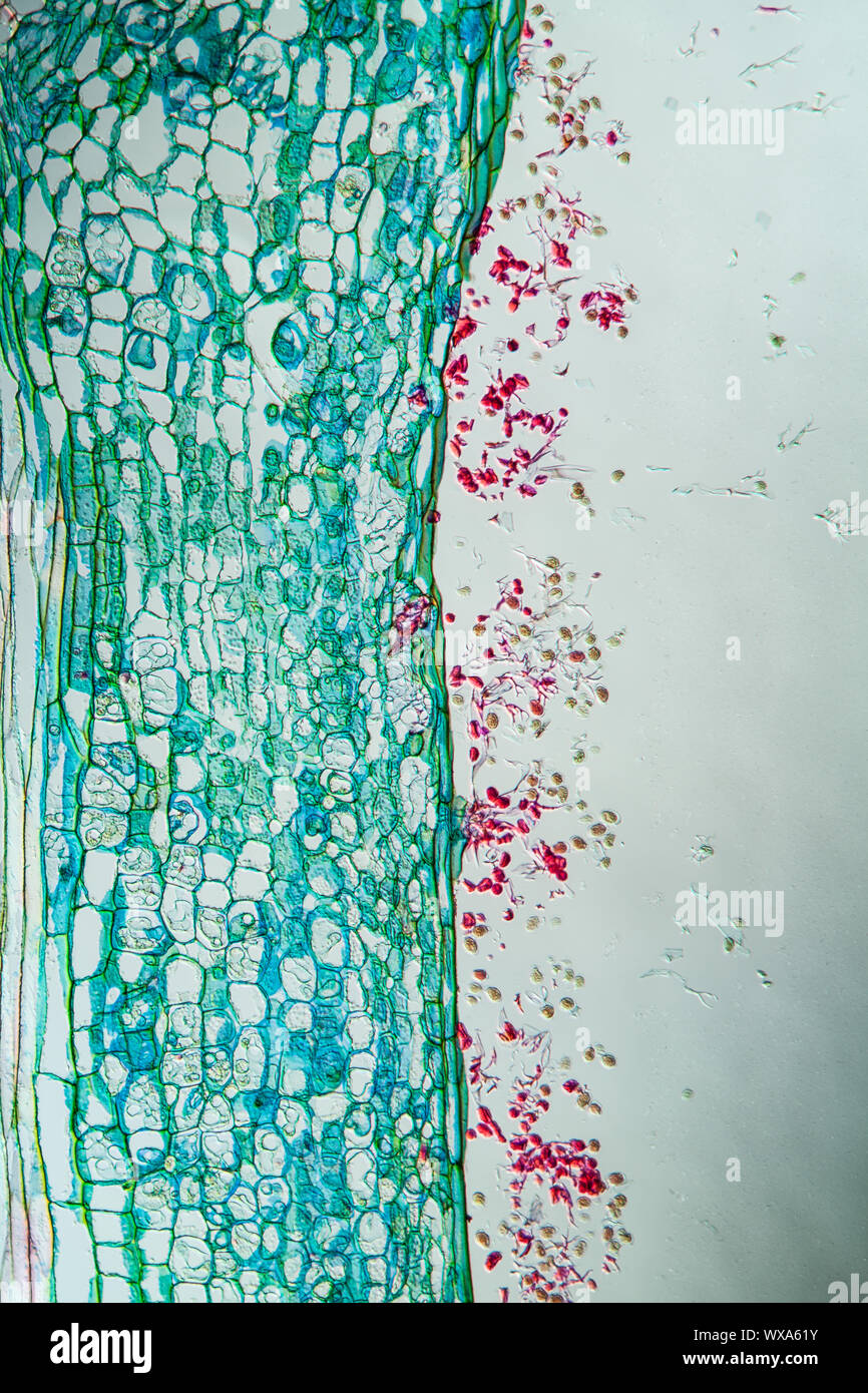 Infezione fungina peronospora sul pastore la borsetta 100x Foto Stock