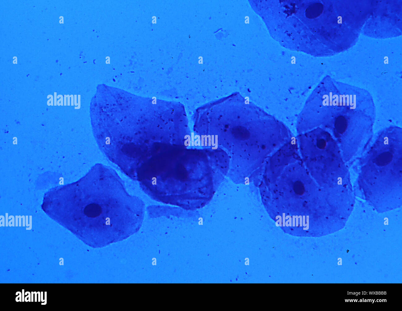 Le cellule epiteliali della mucosa orale sotto il microscopio 200x Foto Stock