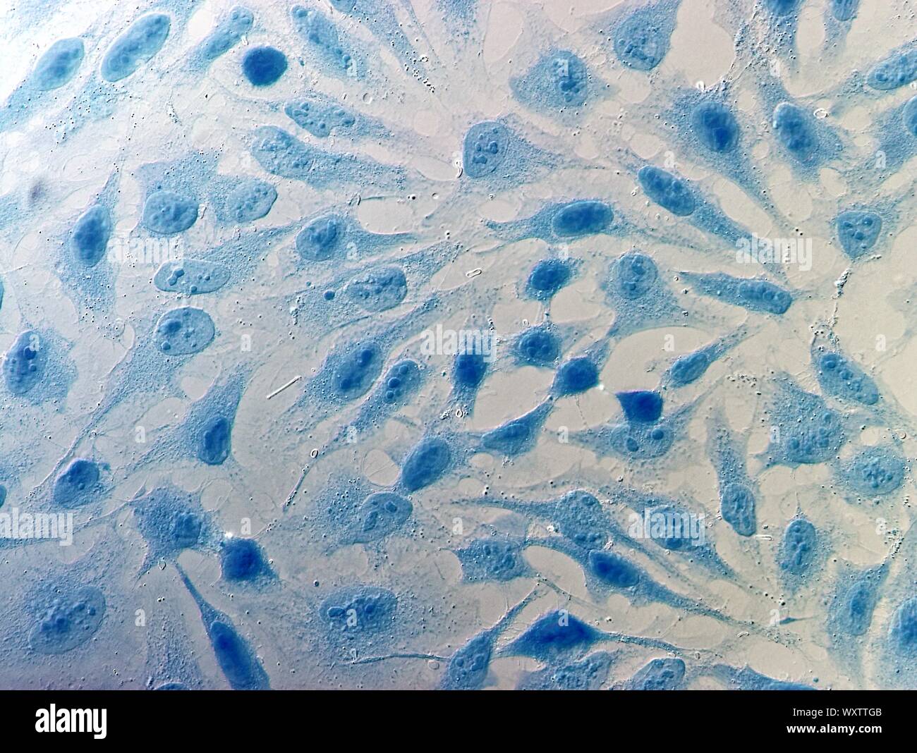 Cellule HeLa cellule di cancro della cervice, colorati con blu Coomassie, sotto microscopio. Foto Stock