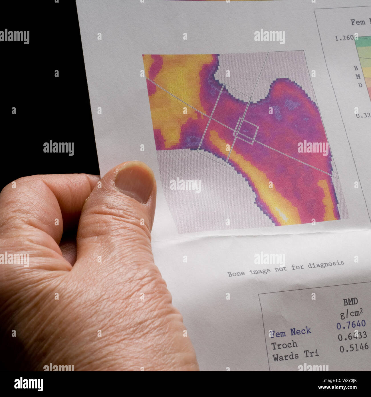 Una mano di una vecchia donna in possesso di una carta stampata con osteoporosi i risultati dei test Foto Stock