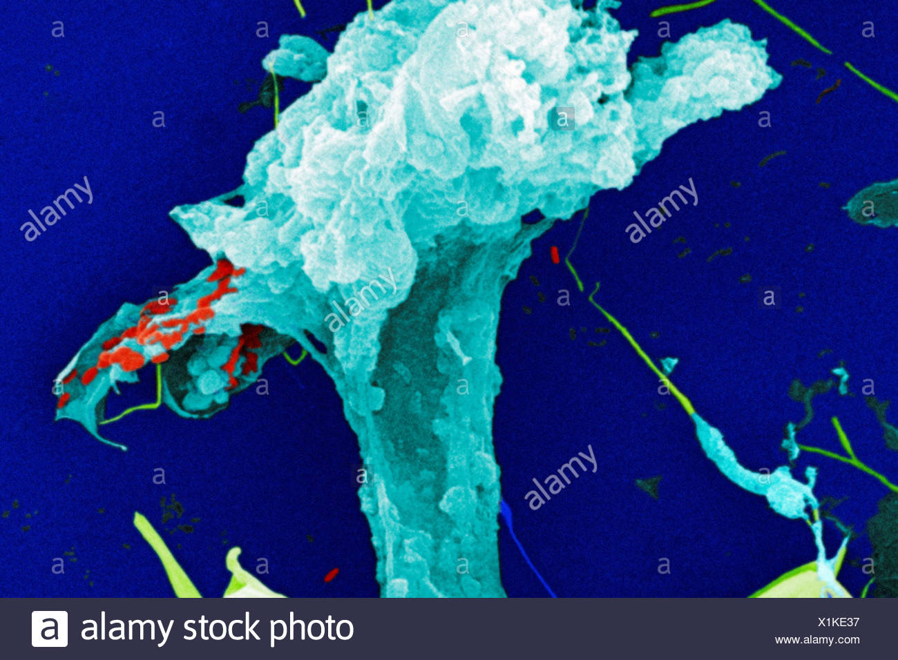 Scanning Electron microfotografia acqua non trattata campione Foto Stock