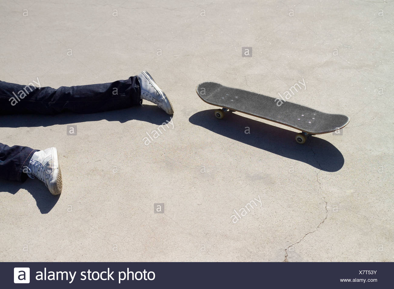 Skateboard Accident Immagini E Fotos Stock Alamy