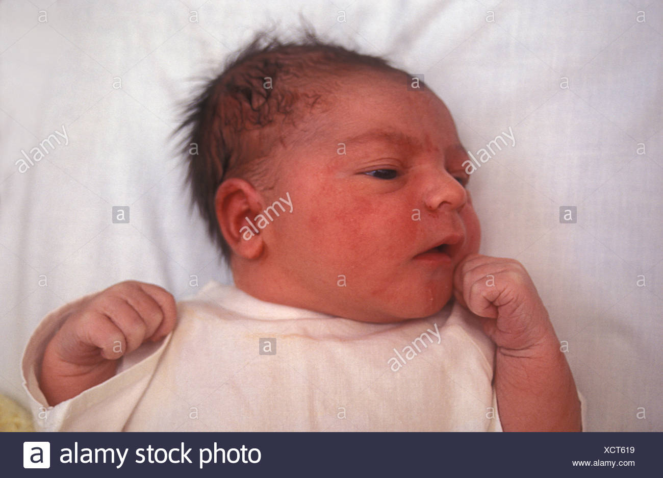I Neonati Con Testa Allungata A Causa Di Un Lungo Lavoro Foto Stock Alamy
