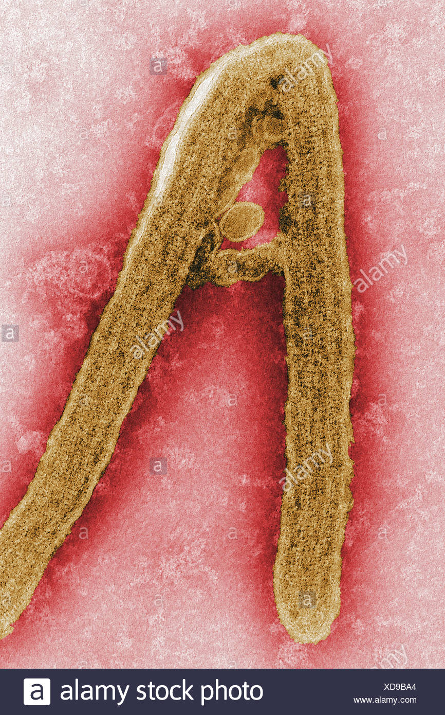 Un Virus Di Marburg Un Virione Che Erano State Coltivate In Ambiente Cellule Di Coltura Tissutale Marburg Febbre Emorragica E Raro Tipo Di Grave Foto Stock Alamy